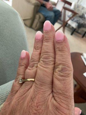 Poor quality manicure with cut cuticles