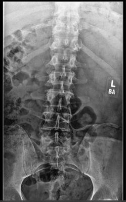 My spine.  Looks good