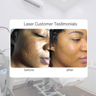 customer laser testimonial