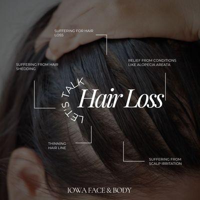 Let's talk Hair Loss