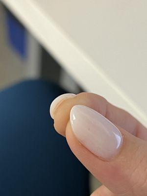 Gap between nail and sns