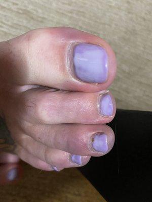 This is how the gel pedicure looked immediately after. Streaky and uneven color.