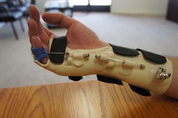 Certified Hand Therapists and Experts at Orthosis (Splint) fabrication