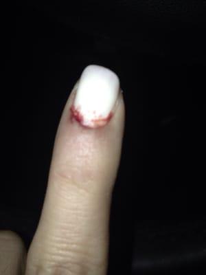 My bloody manicure