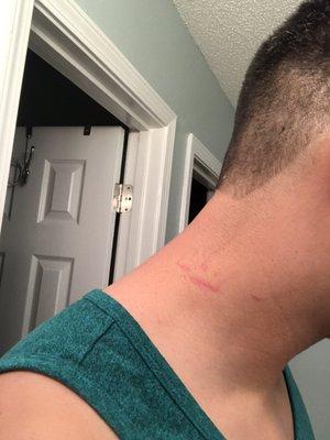 Neck was "Cuts by US"