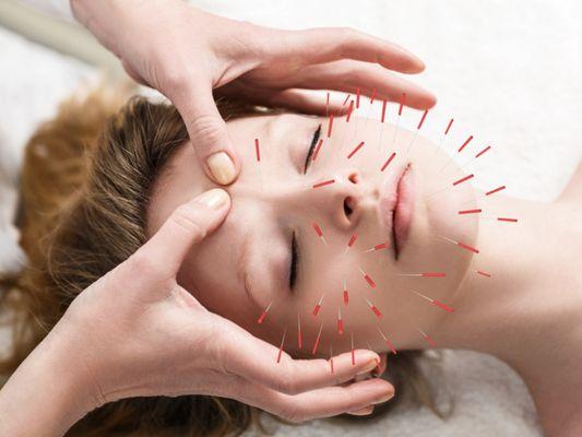 Londa Hackett Acupuncture