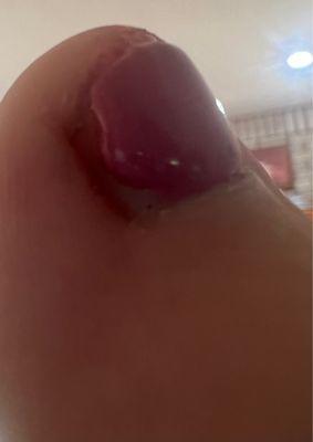 This is my big toe, the rest look the same!