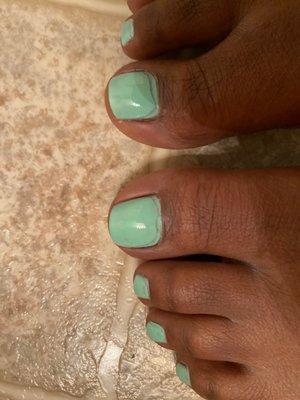 My big toes shouldn't look like this.!