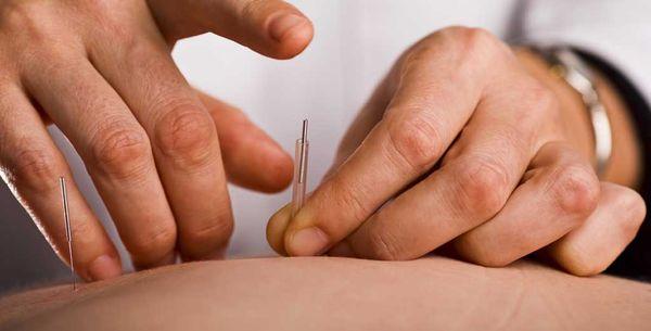 ACA Acupuncture & Wellness - Bayside