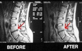 We have the experience to diagnose and treat disc conditions correctly and effectively.