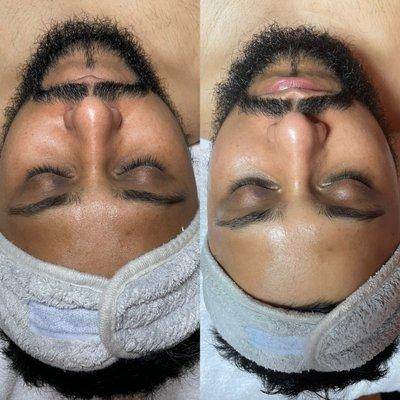 Gentlemen facial