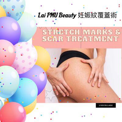 Stretch marks removal inkless