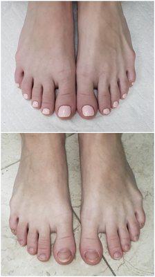 Before and after one gel pedicure