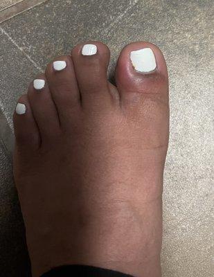 A day after the pedicure