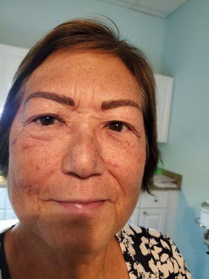 After  Microblading, not yet healed Eyebrows