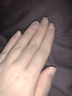 My left hand after using acetone to remove the acrylics (pardon my hairy fingers)