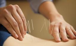 Acupuncture Nyack