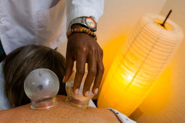 Cupping treatment