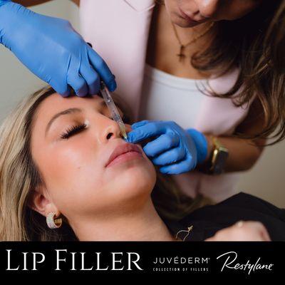 Lip Filler at LIV Dermatology & Aesthetics