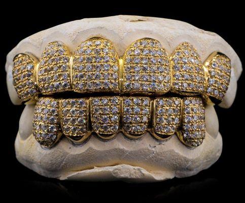 Custom bustdown Grillz