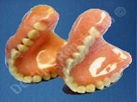 Duplicate dentures