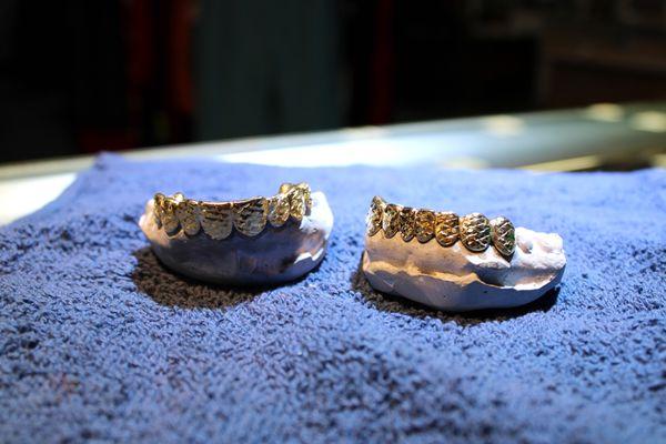 Custom Teeth Grills