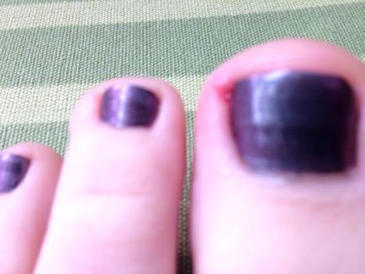 Toe got cut up pretty badly. Had a rough time walking the next day. Nails on hands got jabbed up, too.