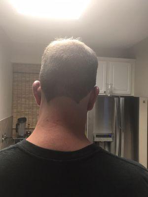 This is what my neck looks like after a haircut here. If you want to refund my haircut, and fix this mess, feel free to reply to this post.