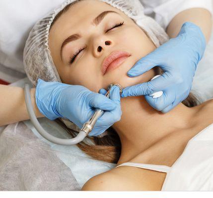 Microdermabrasion treatment