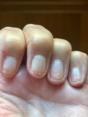 Thin nails with splitting