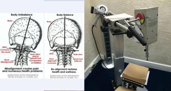 Upper Cervical Adjustment in Cooper Chiropractic Center and a photo The New Atlas specific adjustment instrument