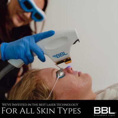 BBL Laser for treating pigmentation, aging, and more at LIV Dermatology & Aesthetics