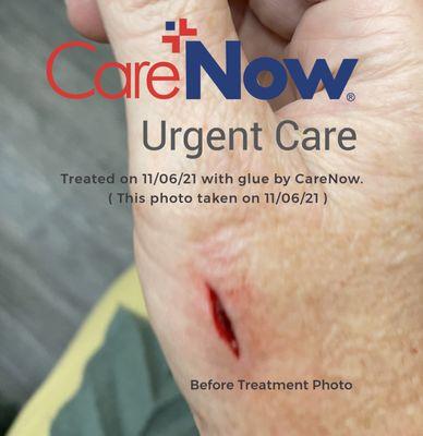 CareNow