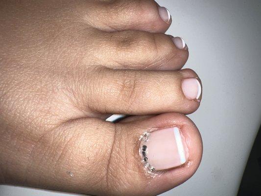 Gel French pedicure and bad placement of jewels