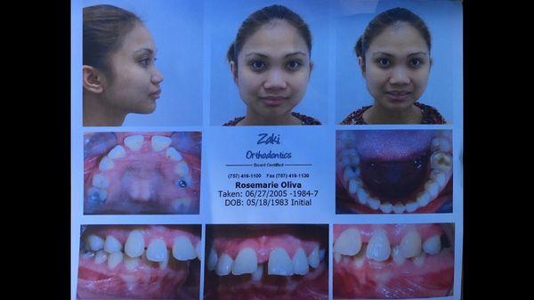 Zaki Orthodontics