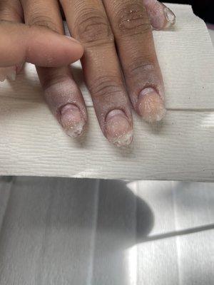 Gummy nails