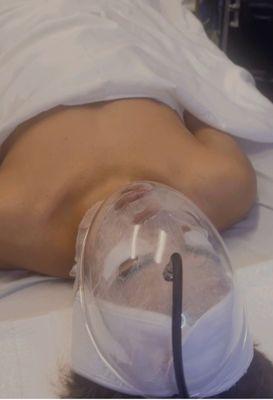 Oxygen Therapy Facial