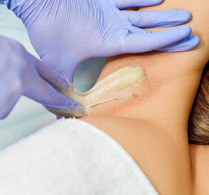 Body Sugaring is conditioning the skin while removing hair down to the root.