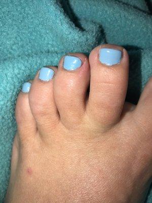 Middle toe swollen and red where I was cut