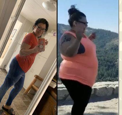 CCS Weight Loss surgery success photo