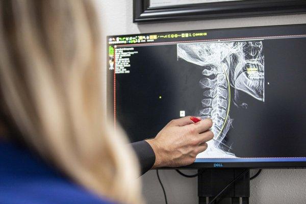 At West End Chiropractic we offer In-House Digital X-Rays