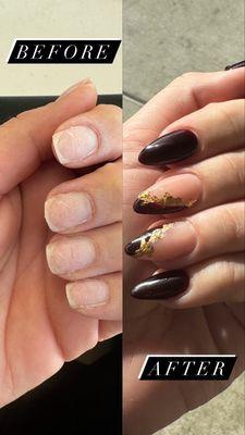 Before and after a full gel x set