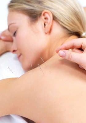 acupuncture for hormone imbalance, insomnia, pain, infertility, autoimmune disorders, community acupuncture