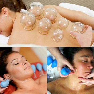 Fire Cupping & suction cupping.  Facial rejuvenation cupping for a natural face lift.