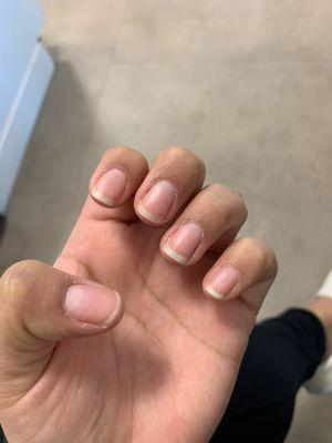 Dry around the nails and the clear nail polish was no longer on my nail due to it peeling off