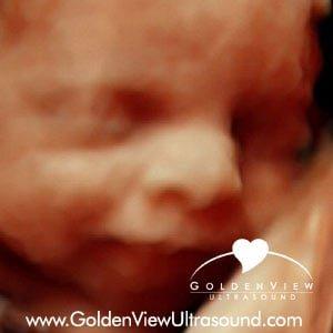 3d/4d ultrasound with HDLive images at GoldenView Ultrasound Chicago. Baby is 27 weeks