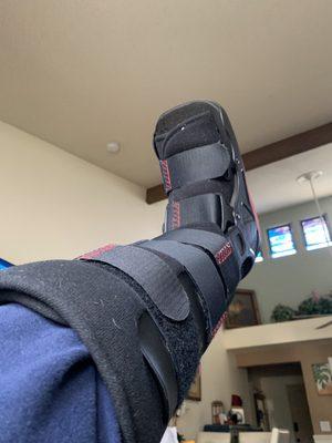 In a boot for two weeks