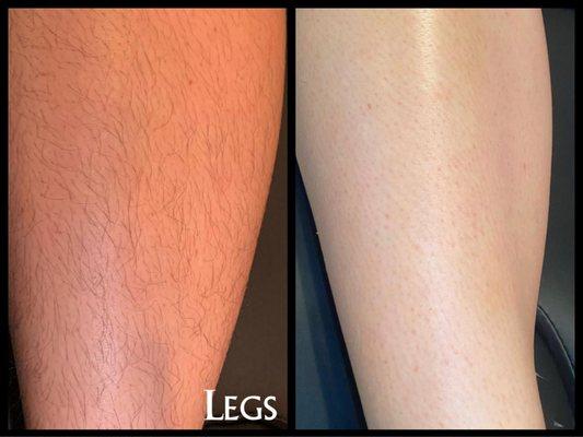 Before and after waxed leg.