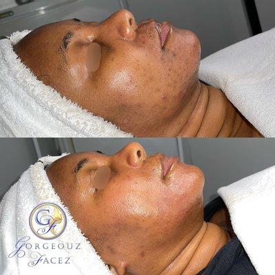 Gorgeouz Facez Spa