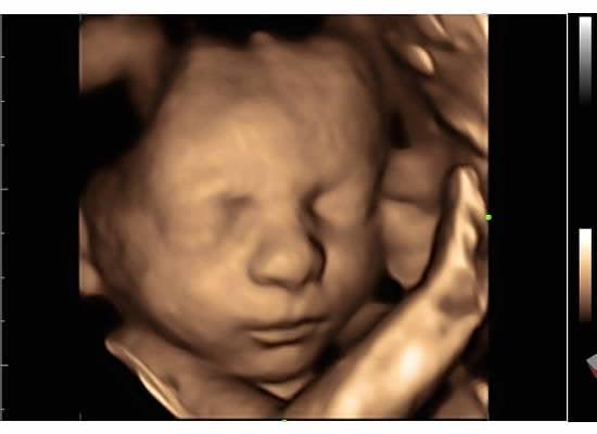 28wk(+5day) 4D Ultrasound. Incredible imaging capabilities. The technology they have in-house paired with the labtech make the experience A+